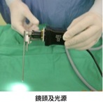 脊椎內視鏡